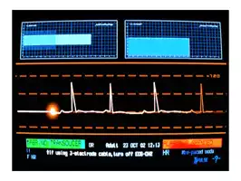 Image of Heart Monitor 11
