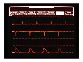 Image of Heart Monitor 05