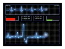 Image of Heart Monitor 01