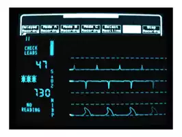 Image of Heart Monitor 04