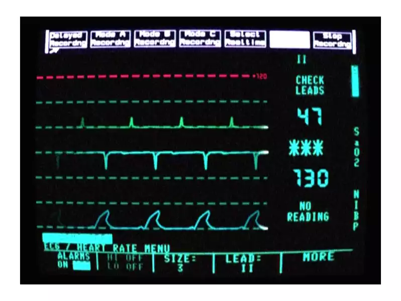 Image of Heart Monitor 02